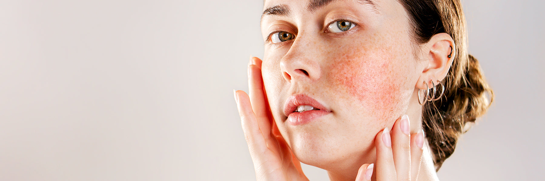 How To Keep Redness Under Control
