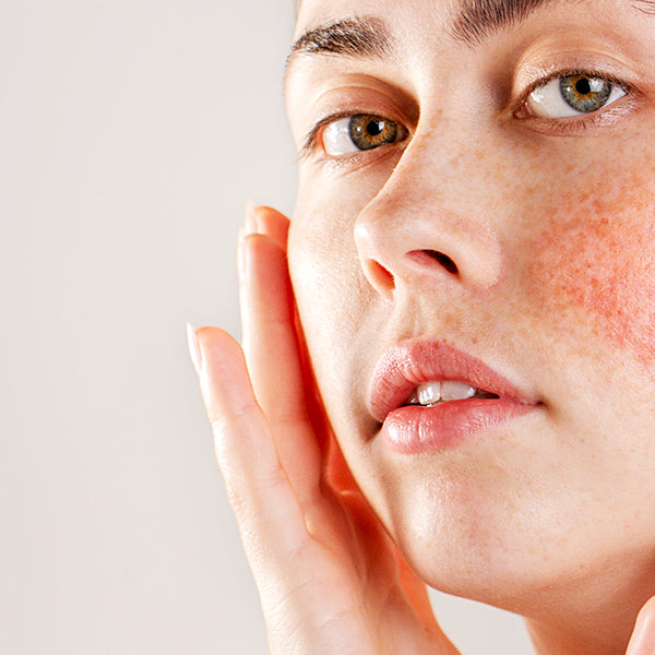 How To Keep Redness Under Control