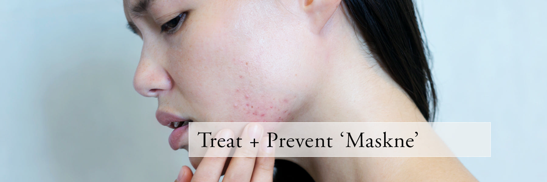 How To Treat and Prevent 'Maskne'