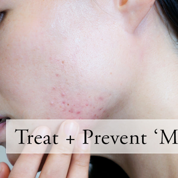 How To Treat and Prevent 'Maskne'